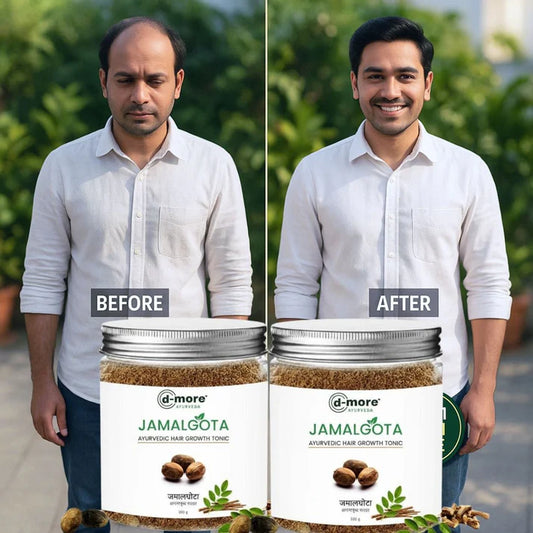 MD Jamalgota Ayurvedic Hair Growth Powder🌿