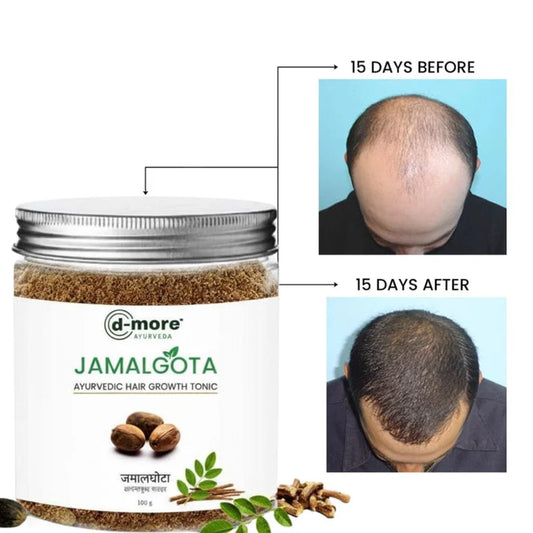 MD Jamalgota Ayurvedic Hair Growth Powder🌿