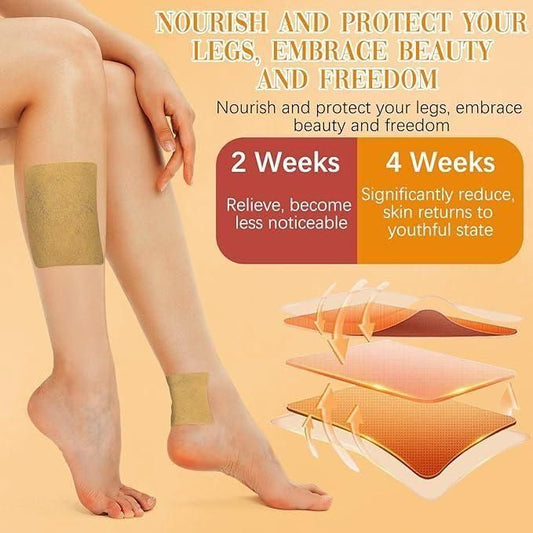 Spider & Varicose Vein Patches